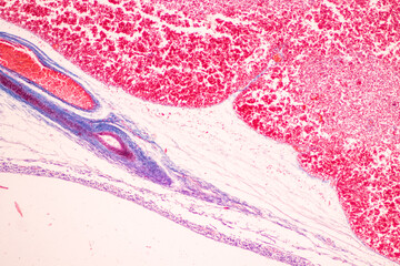 Showing Light micrograph of the Trachea, Thymus, Parathyroid gland and Tonsil  human under the microscope for education in the laboratory.