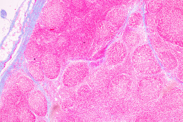 Showing Light micrograph of the Trachea, Thymus, Parathyroid gland and Tonsil  human under the...