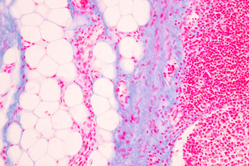 Showing Light micrograph of the Trachea, Thymus, Parathyroid gland and Tonsil  human under the microscope for education in the laboratory.