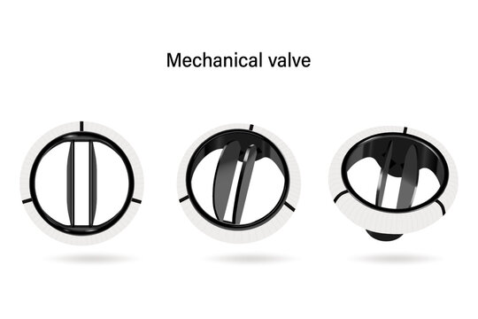 Mechanical valve vector. Aortic valve repair.