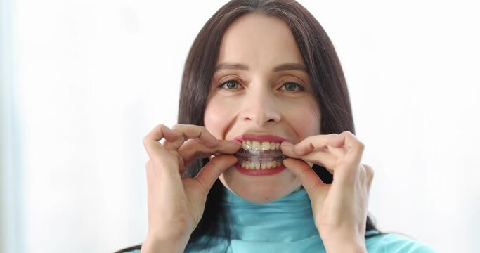 Woman inserting night guard into her mouth to correct bite 4k movie slow motion. Bruxism treatment concept