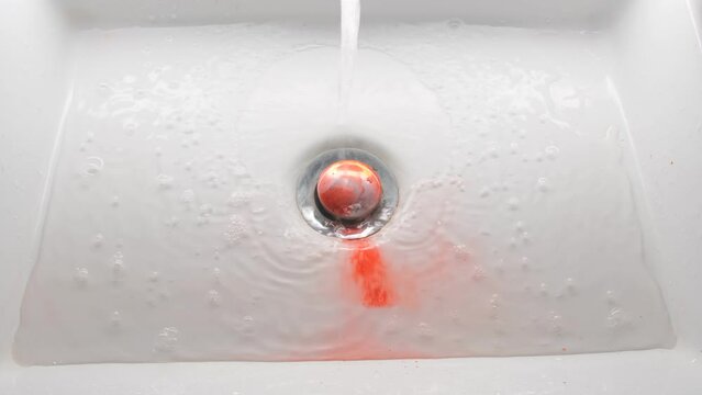 Blood clot in the sink. Problem with gums.