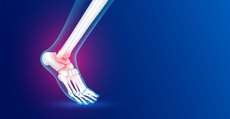 Ankle bone foot traumas and arthritis joint cartilage side on blue background with copy space for text. Human skeleton anatomy healthy. Medical health care science concept. Realistic 3D vector. - obrazy, fototapety, plakaty