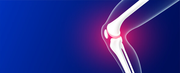 Leg bones and knee joint cartilage inflammation on blue background with copy space for text. Human skeleton anatomy. Medical health care science concept. Realistic 3D vector.