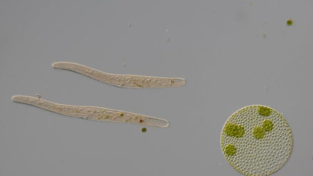 Ein Sumpfwurm ist ein Einzeller aus der Gruppe der Wimpertiere unter dem Mikroskop, Spirostomum