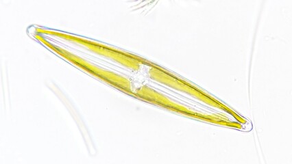 Freshwater diatom, probably Frustulia sp. Collected from the pond. Live cell. Selective focus