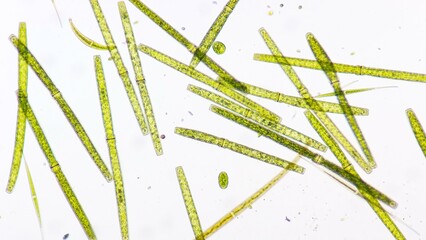 Algae blooming under microscope. The species are Pleurotaenium sp and Closterium sp. Live cell....