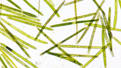 Algae blooming under microscope. The species are Pleurotaenium sp and Closterium sp. Live cell....