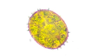 Phytoplankton from water pond, Trachelomonas sp. 4000x magnification. Live cell. Selective focus
