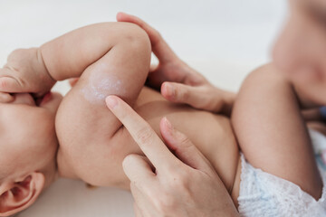 Obraz na płótnie Canvas Tender Motherhood , Mother’s Finger Applying Skin Care Lotion on Her Son’s Arm in Closeup Shot, Embracing the Concept of Baby Care.