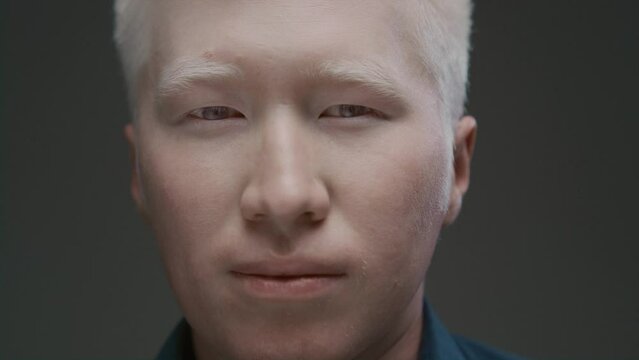 Close up portrait of an albino Asian guy looking at the camera. Genetic mutation of the pigment. Lack of melanin, unusual appearance. The colorless male raises his head. A white man on a dark studio.