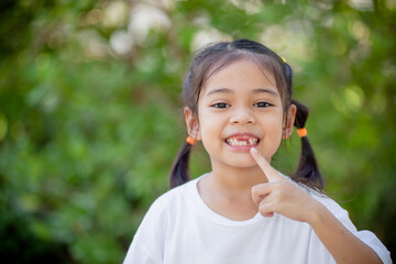 Asian little girl displays a missing tooth.