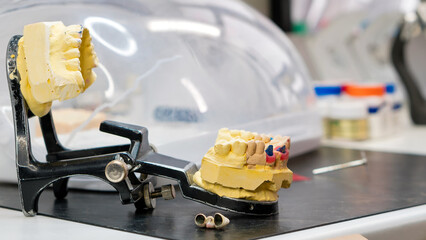 Manufacturing of dentures