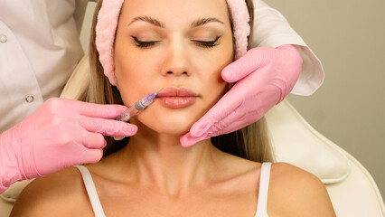 Lip augmentation procedure