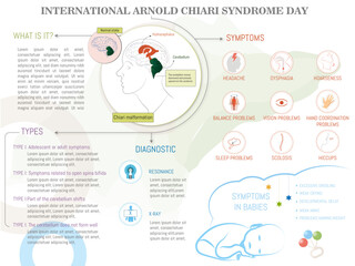 Infographic of Arnold Chiari Syndrome, what it is, symptoms and treatment with icons on soft background.