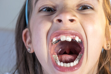 Child during orthodontist visit and oral cavity check-up.