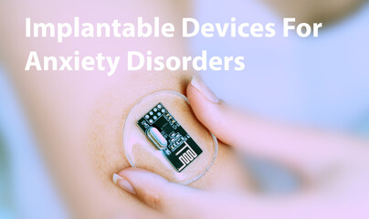 Implantable Devices For Anxiety Disorders Implantable Electronic Medical Devices Concept
