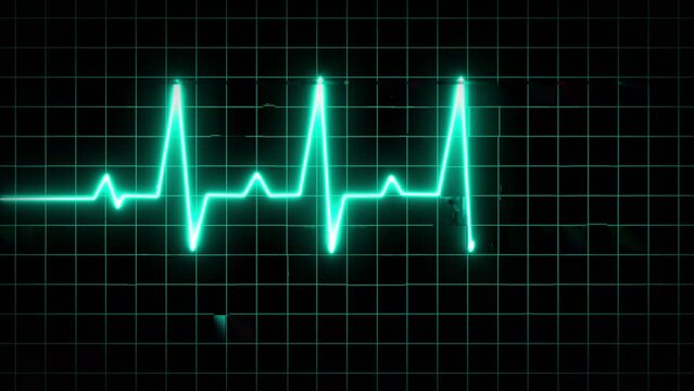 animation of an ecg ekg display. Heart Rate Monitor Electrocardiogram Ekg Or Ecg Looping background