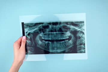 A dentist holding snapshot the patient's tooth.