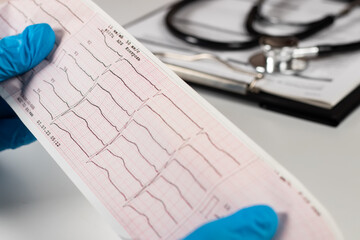 Doctor's hands hold result of the cardiogram next to patient sitting.