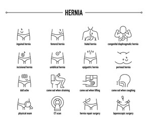 Hernia symptoms, diagnostic and treatment vector icon set. Line editable medical icons.