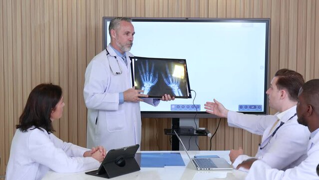 doctors looking at x ray image, Team of male and female doctors gather to discuss a patient's hand x ray, Experts of various nationalities meet to find a cure.