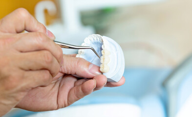 Dentist showing ceramic dental cast in clinic