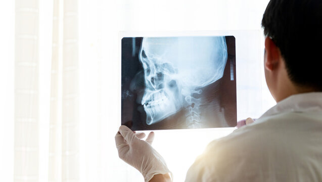 Doctor holding X-ray picture of head
