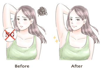 脇の悩みがなくなった女性　水彩風