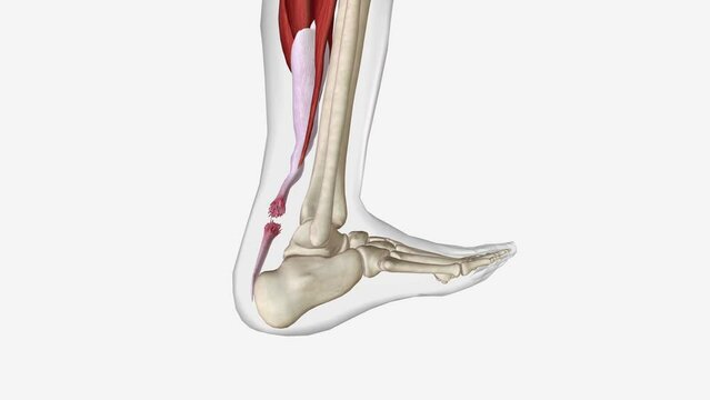 Flexion and Extension with Torn Achilles Tendon
