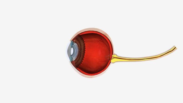 Interstitial keratitis is chronic, nonulcerative inflammation of the mid-stroma that is sometimes associated with uveitis