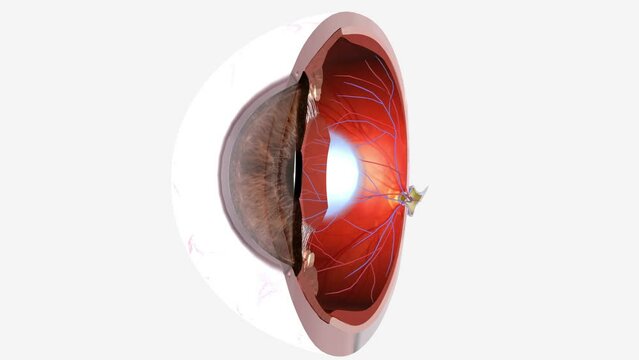 Nearsightedness (myopia) is when close-up objects look clear but distant objects are blurry