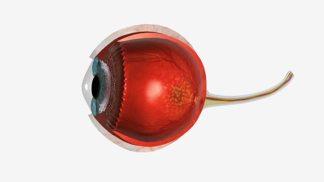 Dry Macular Degeneration 3d