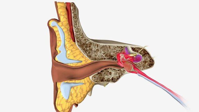 inner ear infection causes parts of your inner ear to become irritated or inflamed