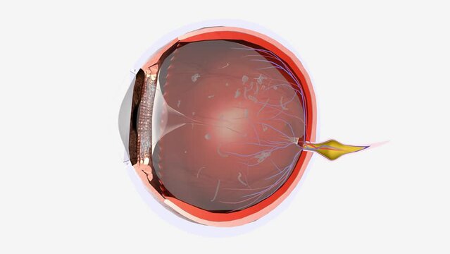 Floaters are small dark shapes that float across your vision