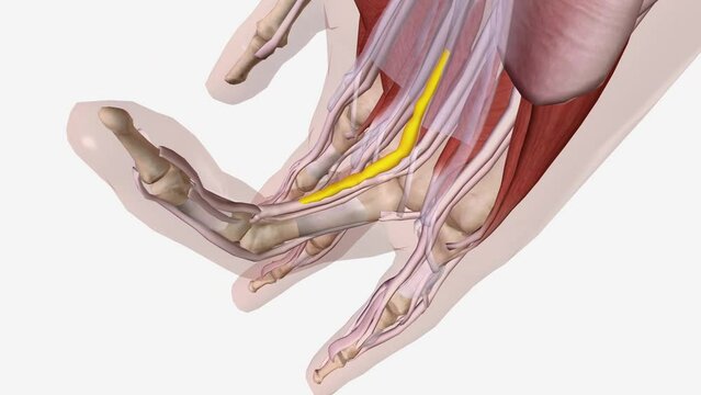 Dupuytren is Contracture Central Cord