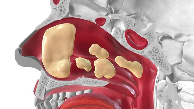 Mucus is a slippery aqueous secretion produced by, and covering, mucous membranes