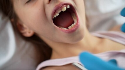 Dental check up. Dentist examining the little girl teeth, close-up