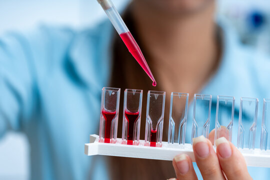 Time-Resolved Fluorescence Spectroscopy: Employ the cuvette to measure