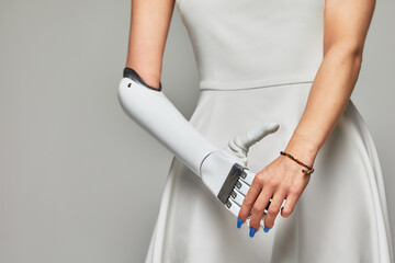 Cropped studio portrait of a young girl with disability wearing sensory bionic prosthetic arm. Beautiful slender woman in a white dress fully controls her artificial robotic hand.