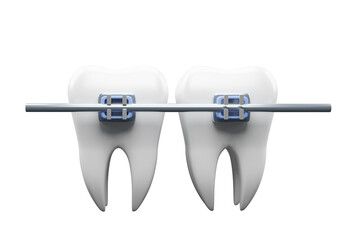 Teeth braces. Teeth alignment.  teeth with braces  . 3d render.