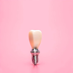 Generative AI.f Dental Implant on isolated pink background.
