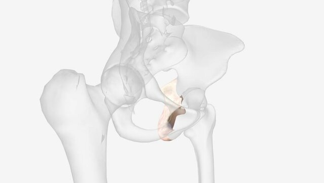 The ischium is made up of three parts the body, the superior ramus and the inferior ramus