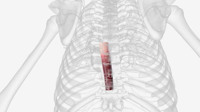 A thoracic aortic aneurysm is a weakened area in the body's main artery in the chest.