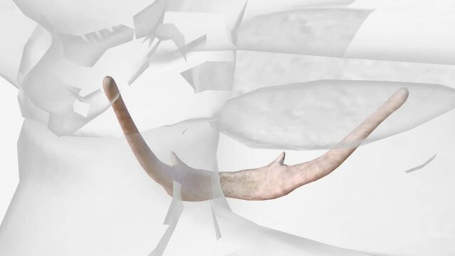 The hyoid bone is a small U-shaped solitary bone, situated in the midline of the neck anteriorly at the base of the mandible
