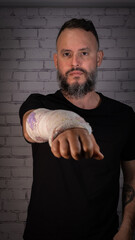 Young man with beard and without glasses, wearing a black T-shirt. Broken arm with plaster painted with children's drawings. Tenerife, Canary Islands, Spain.