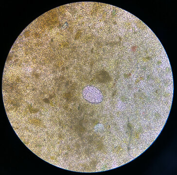 hookworm egg parasites were found in a 40x microscopy examination of human faeces.