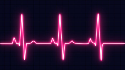 Purple color EKG heart line monitor. Emergency EKG monitoring. pulse line. ECG heartbeat monitor, cardiogram heart pulse line wave. Electrocardiogram Medical Background.