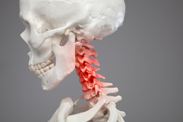 Neck pain, human skeleton, upper spine cervical vertebrae red zone