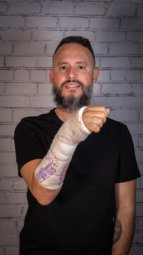 Young man with beard and without glasses, wearing a black T-shirt. Broken arm with plaster painted with children's drawings. Tenerife, Canary Islands, Spain.